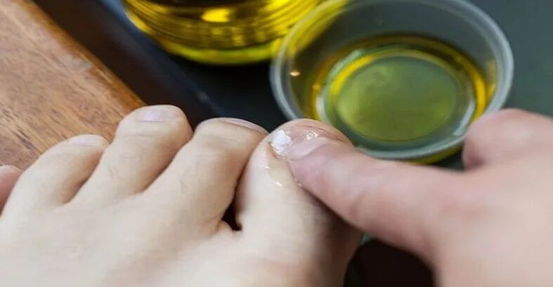 Mantarla savaşmak için uçucu yağlar