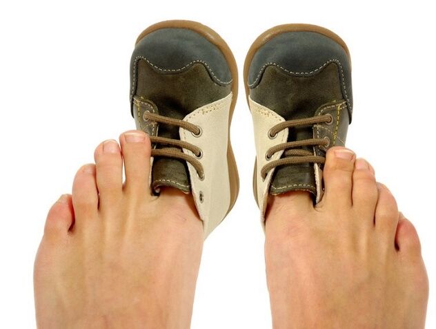 ayak parmakları arasında mantarın bir nedeni olarak sıkı ayakkabılar