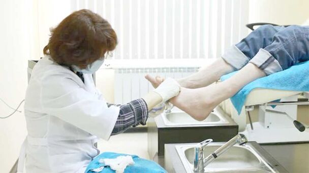 Bir dermatolog ayak tırnağı mantarını tedavi eder