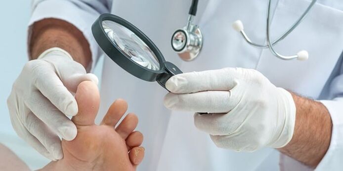 Doktor, bir mantar ile enfekte olan ayağı inceledi